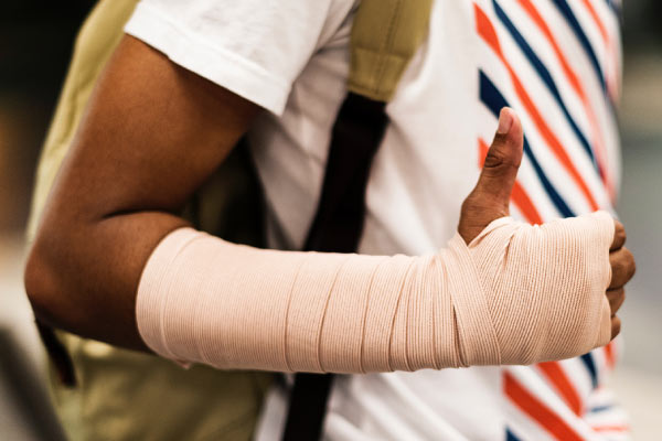 photo of a person's arm in a cast who is wearing a sports-type shirt